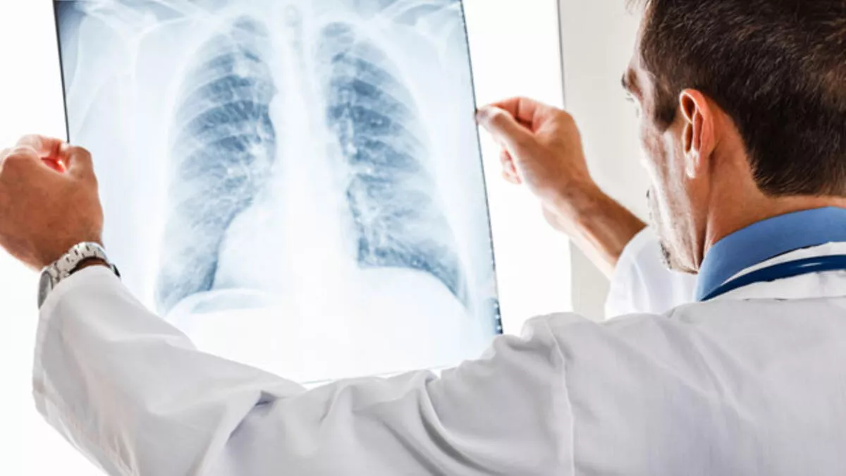 Akciğerde Leke Nedir, Kanser Belirtisi Mi, Nasıl Tedavi Edilir
