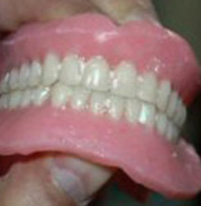 Protez Diş Yutma