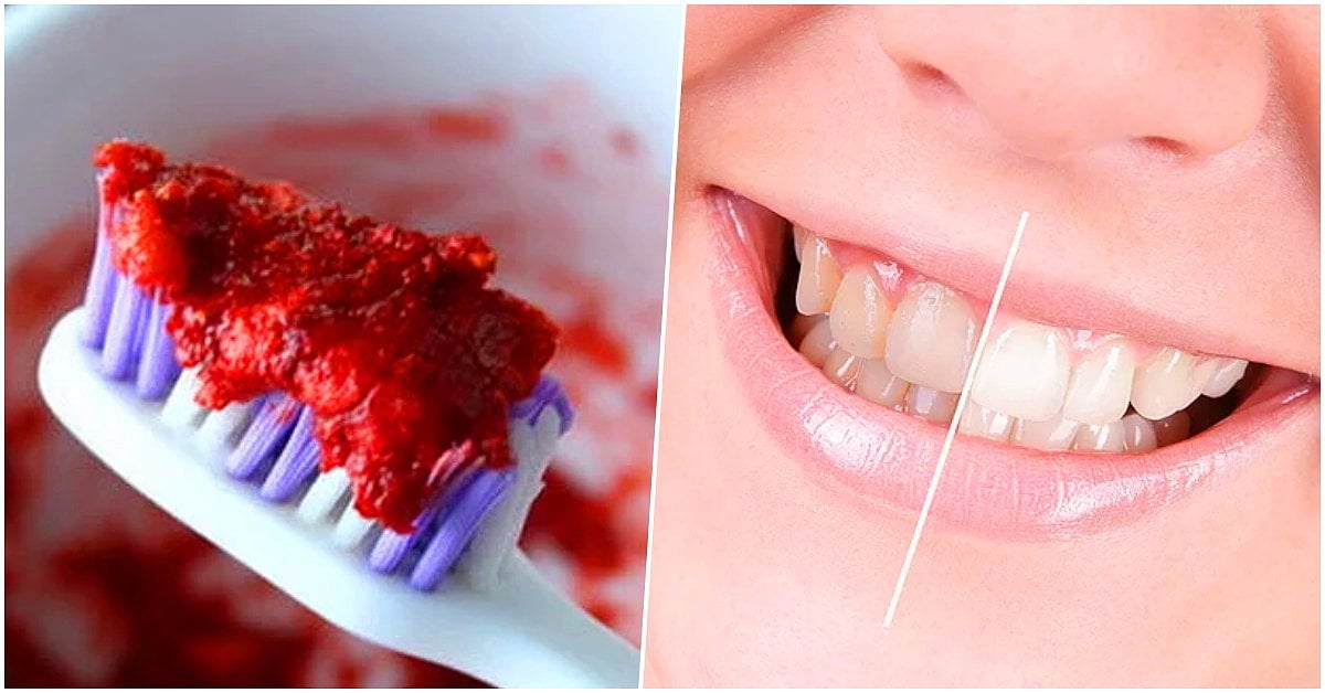 Doğal Diş Temizliği Nasıl Yapılır?